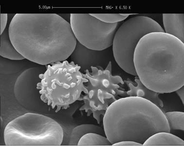 Valori di Riferimento di Alcuni Parametri Ematici Ematocrito M: 39-49 % F: 35-45 % Eritrociti M: 4.5-5.9 x 10 6 /µl F: 4.5-5.1 x 10 6 /µl Reticolociti 0.50-1.50 % Leucociti 4.5-11.