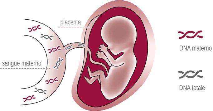 Un test che riduce il rischio per la gestante di sottoporsi ad indagini prenatali invasive non necessarie È un test prenatale non invasivo che rileva anomalie cromosomiche e gravi malattie genetiche