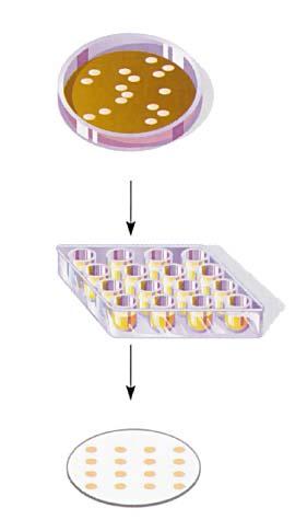 Screening mediante ibridazione con acidi nucleici: arrayed libraries I singoli cloni vengono prelevati e trasferiti in maniera ordinata su una membrana, a formare una griglia.