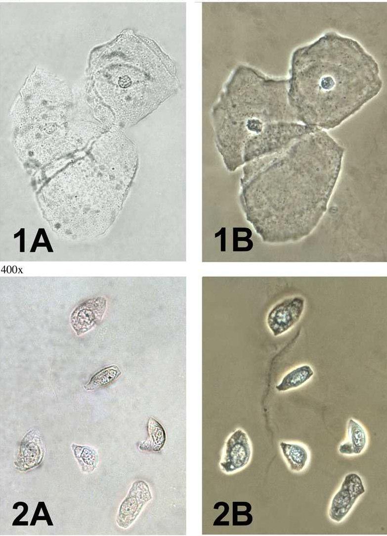 Ciclo 5 - Esercizio 2 Aggregato di 3 cellule squamose Diversi tipi di cellule degli strati profondi