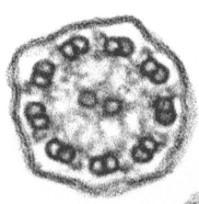 La Discinesia Ciliare primitiva (PCD) è una patologia ereditaria, clinicamente e morfologicamente eterogenea, dovuta ad alterazioni delle cilia mobili delle cellule epiteliali.