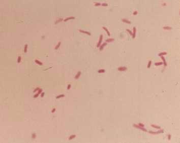 COLIFORMI Microorganismi appartenenti alla famiglia delle Enterobacteriaceae Bacilli Gram negativi Fermentano il lattosio con produzione