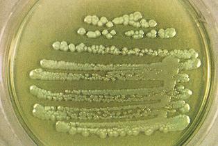 Pseudomonas aeruginosa La sua presenza è indice di inefficaci trattamenti di potabilizzazione Bacillo gram negativo Diffuso nel suolo, nell acqua, nell aria ma anche nelle feci E considerato