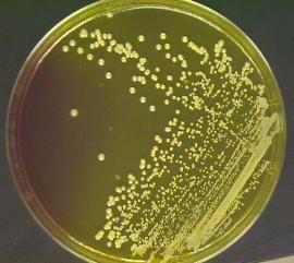 Staphylococcus aureus Cocco Gram positivo Appartiene alla famiglia delle Micrococcaceae E l unica specie patogena per l uomo con una frequenza di portatori nasali di circa il 20%.