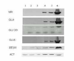 SDS-PAGE IMMUNODECORAZIONE (WESTERN