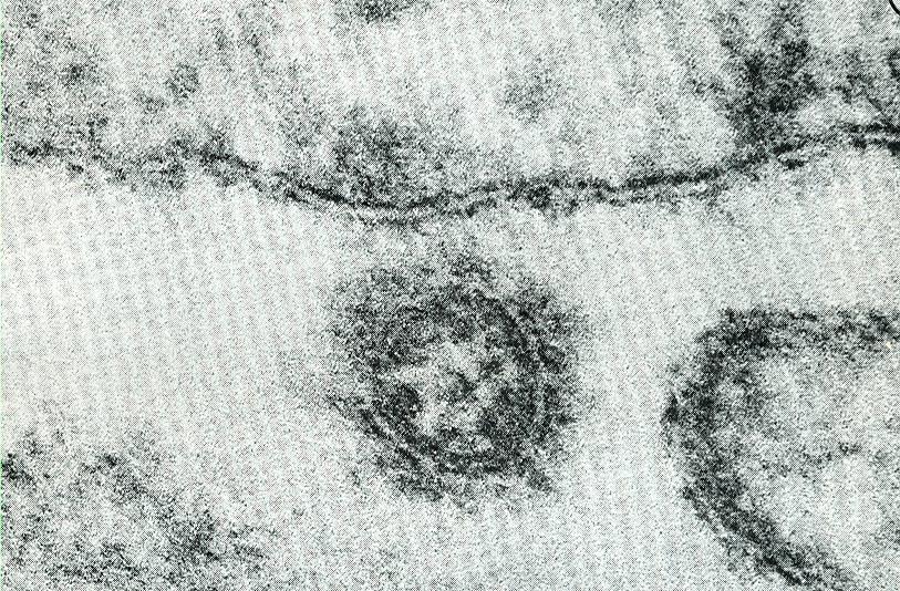 Eziologia Influenza--virus A B C Influenza Famiglia Orthomyxoviridae, virus a RNA a