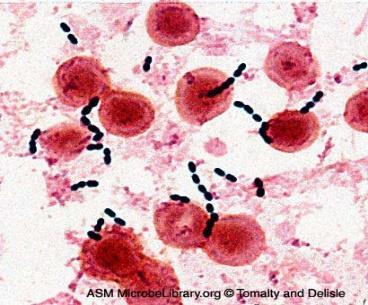 DIFFUSIONE DELL INFEZIONE Modalità di diffusione: Sangue microrganismi circolanti come tali (esposti alle difese dell ospite) o protetti all interno di cellule circolanti (linfociti, monociti: EBV,