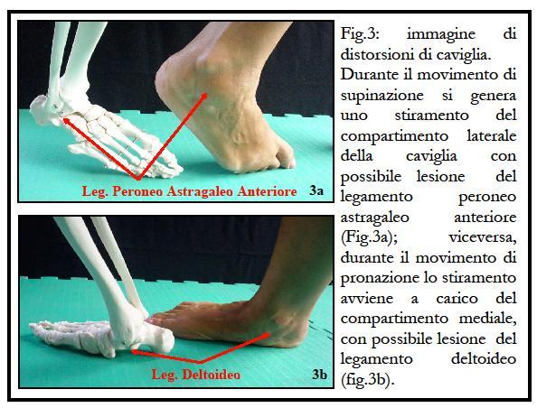 la supinazione è quel movimento che porta la pianta del piede verso l interno (Fig.3a), la pronazione è invece il movimento opposto (Fig.3b).