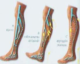 Durante la deambulazione, l azione della pompa svuota verso l'alto e in modo intermittente il contenuto venoso dell arto più velocemente di quanto non si possa riempire dal basso per apporto