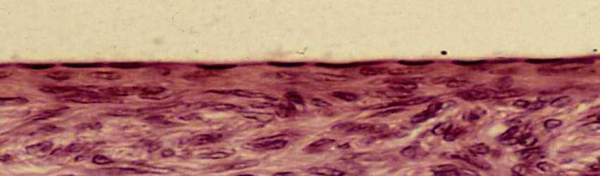 Lo ritroviamo: negli alveoli polmonari in alcune parti del rene (foglietto parietale della capsula del