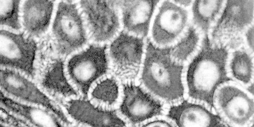 Cellule dello strato spinoso dell epidermide, osservate al microscopio ottico ad alto