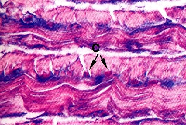 Cartilagine fibrosa (dischi intervertebrali, sinfisi pubica, inserzione tendini sull osso, menischi articolari, legamento del femore) spesso è associata alla jalina possiede molte fibre di collagene