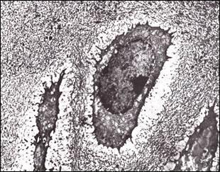 - inorganica: cristalli di idrossiapatite composti da calcio e fosforo, allineati lungo le fibrille collagene Calcificazione dell osso Prima fase: formazione nella matrice di minuti