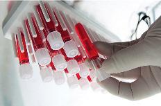 DONAZIONE E TRASFUSIONE Per DONAZIONE si intende il prelievo di sangue intero o di singoli emocomponenti mediante separatori cellulari i quali, attraverso kit monouso sterili, permettono la raccolta