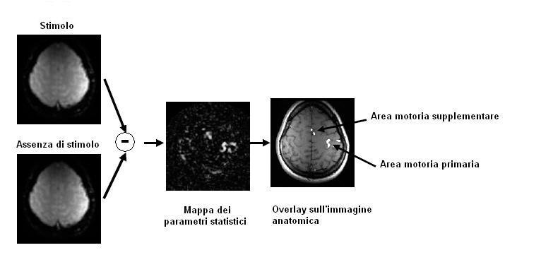 Figura 6: rappresentazione grafica di come si ottiene la mappa dei parametri statistici, cioè l immagine statistica parametrica (sottrazione mediata tra l immagine acquisita durante la presentazione