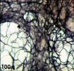 Tessuto connettivo areolare (o lasso): le cellule soni i f ibroblasti e producono fibre proteiche Le fibre collagene sono molto resistenti; le fibre elastiche (formate dalla proteina elastina) sono