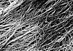 Tessuto connettivo fibroso: composto da fibre collagene parallele, pochi fibroblasti interposti garantendo forza e flessibilità si trova nelle pareti esterne delle arterie per resistere alla