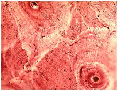 di riposo. Altra localizzazione è intorno agli alveoli Osso: osteo cellule sono gli osteociti.