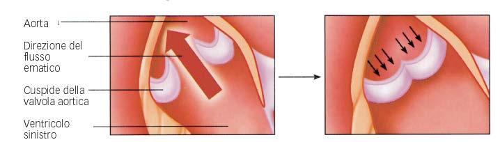 Le valvole semilunari Aortica (sinistra) e polmonare (destra) 3 cuspidi a forma di coppa Localizzate tra i ventricoli e le arterie Si aprono quando la pressione ventricolare supera quella arteriosa