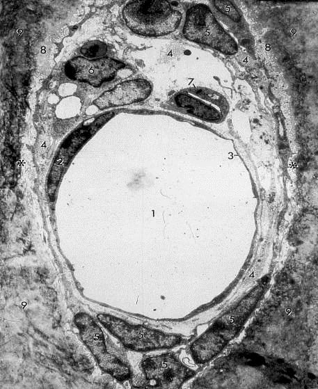 osteoide Fibrille collagene osteoide Macrofago OPro Piccolo capillare capillare venoso