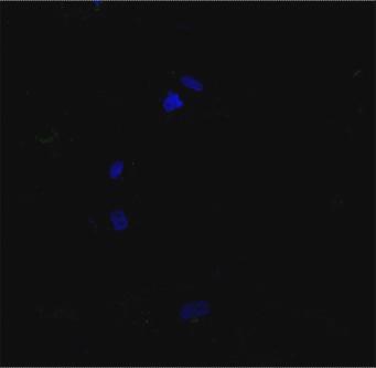 Le cellule TSC sono risultate positive all anticorpo anti α-actina, marcatore di cellule muscolari lisce.