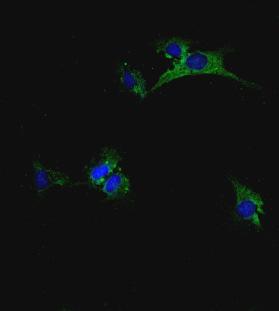 Sangue proveniente da un controllo sano Sangue del paziente affetto da TSC Cellule isolate dall AML c) VSMC A549 cell.