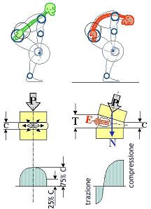 Il disco intervertebrale è una delle strutture maggiormente esposte ad alterazioni strutturali, in quanto deve sostenere carichi importanti ogni qual volta si debbano sollevare o trasportare pesi.