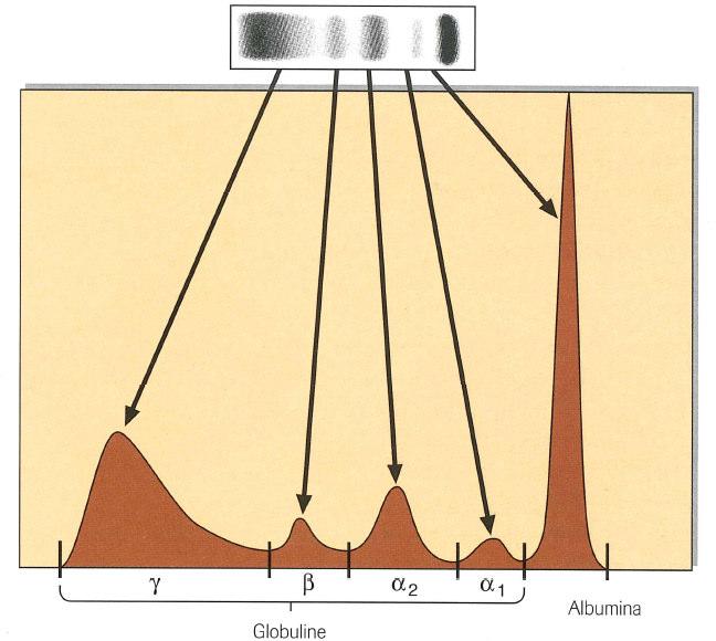 Elettroforesi delle proteine plasmatiche Con l elettroforesi su acetato di cellulosa in tampone basico (8.
