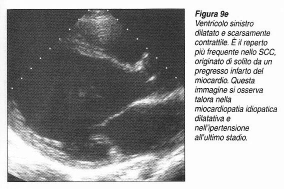 Ecocardiografia bidimensionale Metodica che permette