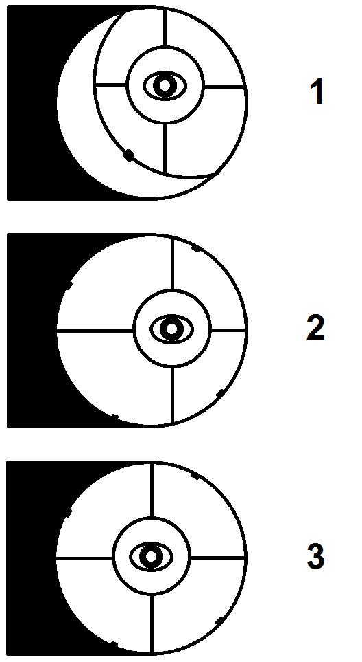 6. Allineamento del sistema ottico e della collimazione. I telescopi necessitano di una verifica periodica dell allineamento del sistema ottico.
