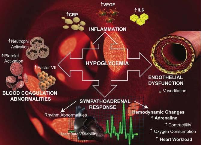 Conseguenze cardiovascolari dell ipoglicemia: fisiopatologia CRP, C-reactive protein; IL-6,