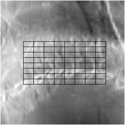 algorithm search the same grid on the xray images (live