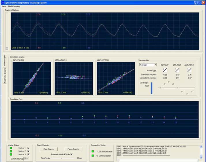 SYNCHRONY TRACKING SYNCHRONY USER INTERFACE Breathing pattern waveform from tracking markers 29/04/2014 Ninfa Satariano U.O.C. di Fisica