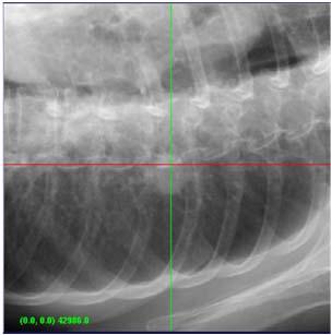 XSIGHT LUNG TRACKING DRR Similarity Measure Matching window Maximum similarity LIVE Search