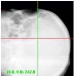 images with a set of DRR DRR XRAY IMAGES 29/04/2014 Ninfa