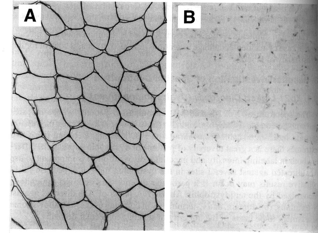 Distrofina Marcatura della distrofina con anticorpi specifici in