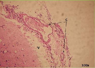 Il plesso corioideo è una struttura vascolare che origina dalla parete di ciascuno dei quattro ventricoli (V) dell encefalo, e che è responsabile della produzione del liquido cefalo rachidiano (LCR).