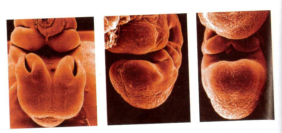 La bocca primitiva -La cavità orale primitiva è formata dallo stomodeo (ectoderma) e dal tratto iniziale dell intestino anteriore (endoderma), che entrano in comunicazione quando si rompe la membrana