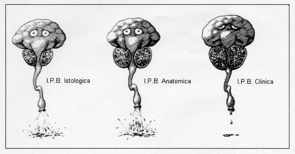 I.P.B.