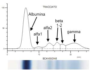 Elettroforesi su acetato di cellulosa