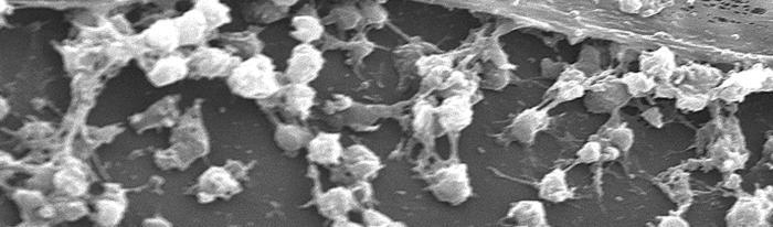 antimicrobici e alle difese dell ospite Fotografia al microscopio elettronico di batteri (stafilococco aureo)