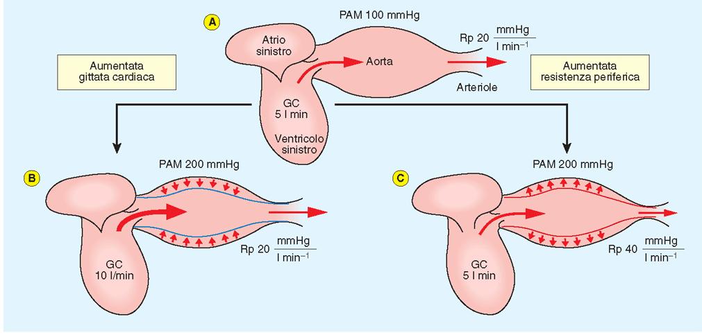 Gettata cardiaca e resistenza periferica influenzano la pressione arteriosa media PAM = Q x R R = 8 η l π r 4 SE AUMENTA LA GITTATA CARDIACA (RESISTENZA PERIFERICA
