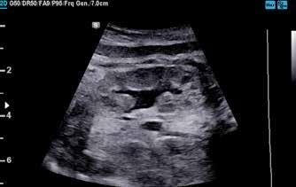 View Viso di un feto con