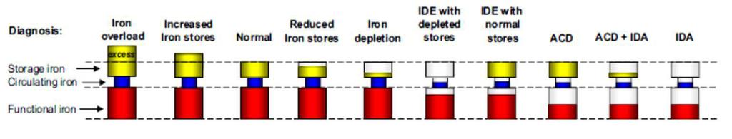 Iron deficiency NORMALE ACD anemia of chronic disease IDA iron-deficiency anemia; IDE iron-deficient