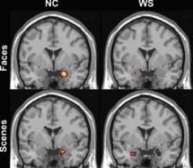 Riceve afferenze dal sistema olfattivo, dalle cortecce associative, dalla corteccia frontale e dal resto del sistema limbico.