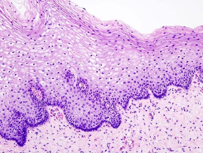 LA FORMA NEI VARI TIPI DI CELLULE NEGLI ANIMALI (II) Le cellule epiteliali: hanno funzione protettiva verso gli agenti esterni e per questo