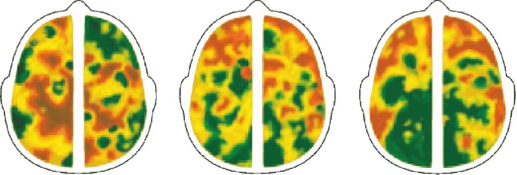 La visualizzazione della circolazione sanguigna nella corteccia cerebrale evidenzia che, a seconda del compito mnestico, si attivano aree diverse.