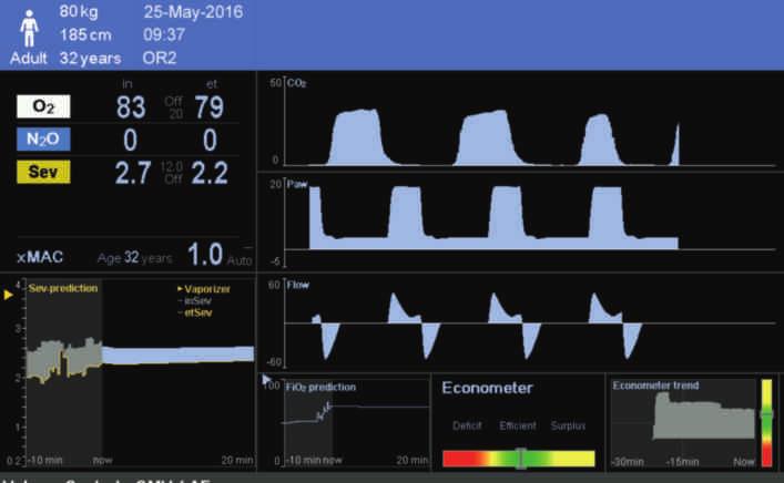 05 SmartPilot View può anche supportare la respirazione spontanea precoce perché l operatore può vedere lo sviluppo dell effetto-concentrazione calcolato per i singoli medicinali e l effetto