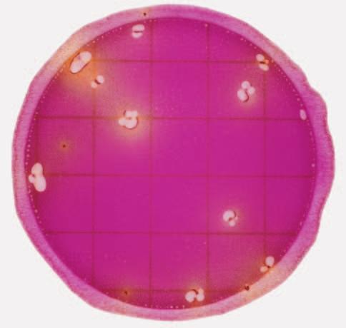 Guida all'interpretazione Petrifilm Piastre per il conteggio di Enterobacteriaceae 1 2 1 2 Conteggio di Enterobacteriaceae = 1 Il conteggio di Enterobacteriaceae è facile utilizzando le piastre