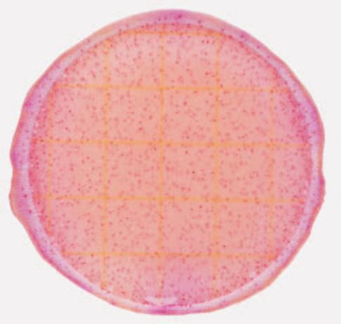 Conteggio di Enterobacteriaceae = non effettuabile In figura 7, il numero di colonie è così alto che le zone acide e le bolle di gas non sono facilmente visibili.